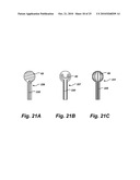 Inductively heated snare diagram and image