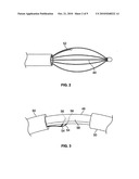 DEVICES AND METHODS FOR TRACKING AN ENERGY DEVICE WHICH TREATS ASTHMA diagram and image