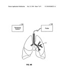 DEVICES AND METHODS FOR TRACKING AN ENERGY DEVICE WHICH TREATS ASTHMA diagram and image