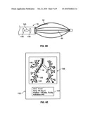 DEVICES AND METHODS FOR TRACKING AN ENERGY DEVICE WHICH TREATS ASTHMA diagram and image