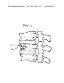 EXPANDABLE POROUS MESH BAG DEVICE AND METHODS OF USE FOR REDUCTION, FILLING, FIXATION AND SUPPORTING OF BONE diagram and image