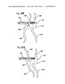 EXPANDABLE POROUS MESH BAG DEVICE AND METHODS OF USE FOR REDUCTION, FILLING, FIXATION AND SUPPORTING OF BONE diagram and image