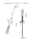 Devices and Methods for Vertebrostenting diagram and image