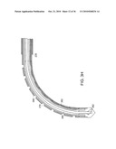 Devices and Methods for Vertebrostenting diagram and image