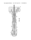 Devices and Methods for Vertebrostenting diagram and image