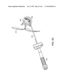 Devices and Methods for Vertebrostenting diagram and image