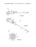 Devices and Methods for Vertebrostenting diagram and image