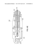 Devices and Methods for Vertebrostenting diagram and image