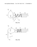 Devices and Methods for Vertebrostenting diagram and image