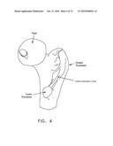 METHOD AND APPARATUS FOR ACCESSING THE INTERIOR OF A HIP JOINT, INCLUDING THE PROVISION AND USE OF A NOVEL TELESCOPING ACCESS CANNULA AND A NOVEL TELESCOPING OBTURATOR diagram and image