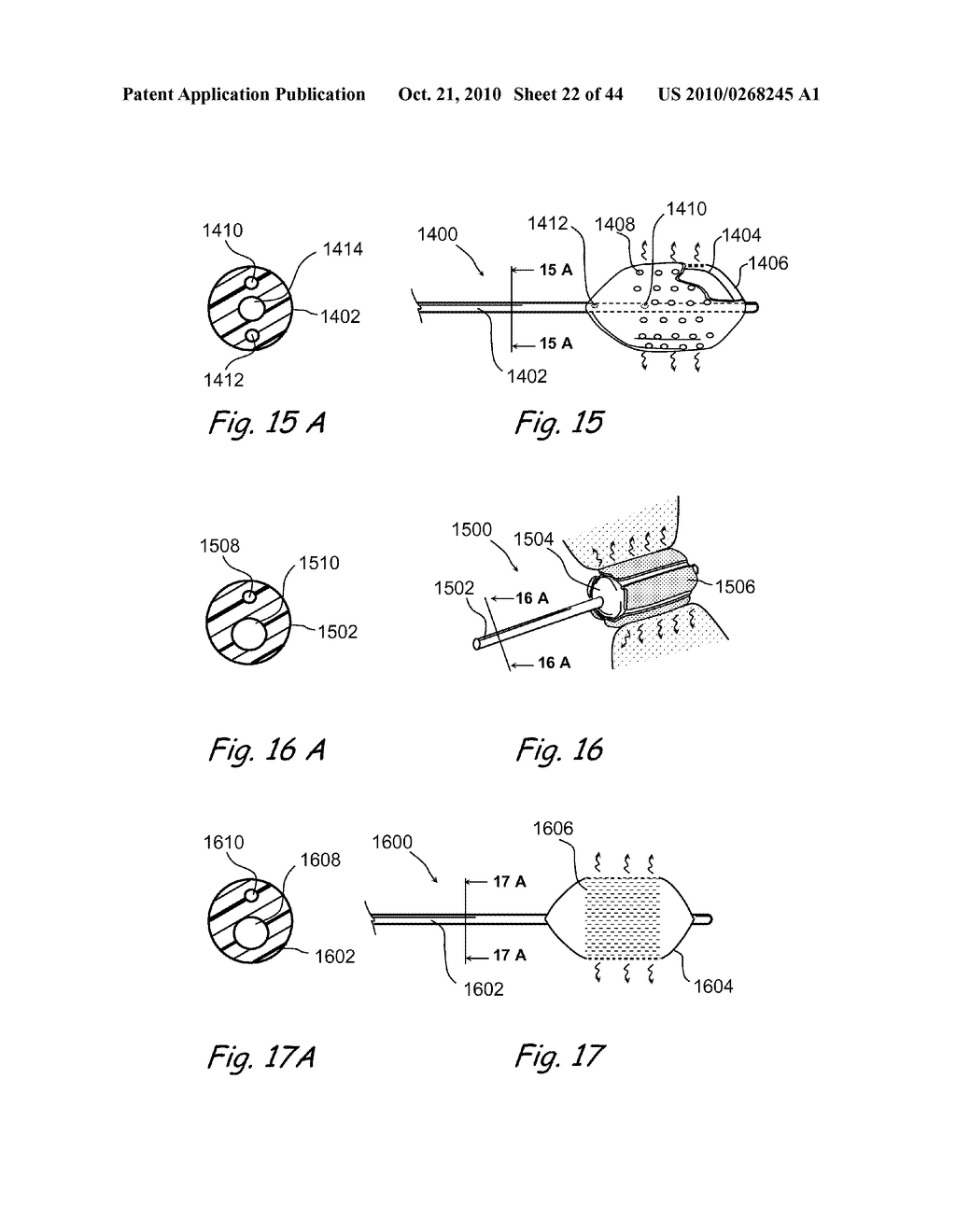 Devices, Systems and Methods for Treating Disorders of the Ear, Nose and Throat - diagram, schematic, and image 23