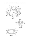 Scaled head frame positioner and tabletop adapter diagram and image