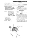 Method and apparatus for restricting flow through an opening in the side wall of a body lumen, and/or for reinforcing a weakness in the side wall of a body lumen, while still maintaining substantially normal flow through the body lumen diagram and image