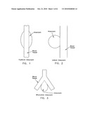 Method and apparatus for restricting flow through an opening in the side wall of a body lumen, and/or for reinforcing a weakness in the side wall of a body lumen, while still maintaining substantially normal flow through the body lumen diagram and image