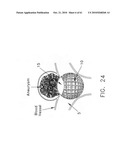 Method and apparatus for restricting flow through an opening in the side wall of a body lumen, and/or for reinforcing a weakness in the side wall of a body lumen, while still maintaining substantially normal flow through the body lumen diagram and image