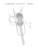 Method and apparatus for restricting flow through an opening in the side wall of a body lumen, and/or for reinforcing a weakness in the side wall of a body lumen, while still maintaining substantially normal flow through the body lumen diagram and image