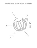 Method and apparatus for restricting flow through an opening in the side wall of a body lumen, and/or for reinforcing a weakness in the side wall of a body lumen, while still maintaining substantially normal flow through the body lumen diagram and image