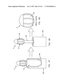 Method and apparatus for restricting flow through an opening in the side wall of a body lumen, and/or for reinforcing a weakness in the side wall of a body lumen, while still maintaining substantially normal flow through the body lumen diagram and image