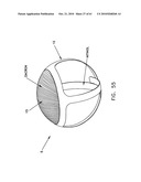 Method and apparatus for restricting flow through an opening in the side wall of a body lumen, and/or for reinforcing a weakness in the side wall of a body lumen, while still maintaining substantially normal flow through the body lumen diagram and image