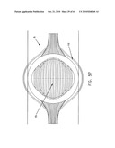 Method and apparatus for restricting flow through an opening in the side wall of a body lumen, and/or for reinforcing a weakness in the side wall of a body lumen, while still maintaining substantially normal flow through the body lumen diagram and image