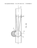 Method and apparatus for restricting flow through an opening in the side wall of a body lumen, and/or for reinforcing a weakness in the side wall of a body lumen, while still maintaining substantially normal flow through the body lumen diagram and image