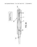 Method and apparatus for restricting flow through an opening in the side wall of a body lumen, and/or for reinforcing a weakness in the side wall of a body lumen, while still maintaining substantially normal flow through the body lumen diagram and image