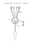 Method and apparatus for restricting flow through an opening in the side wall of a body lumen, and/or for reinforcing a weakness in the side wall of a body lumen, while still maintaining substantially normal flow through the body lumen diagram and image