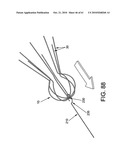 Method and apparatus for restricting flow through an opening in the side wall of a body lumen, and/or for reinforcing a weakness in the side wall of a body lumen, while still maintaining substantially normal flow through the body lumen diagram and image