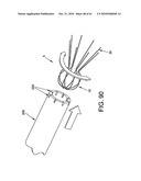 Method and apparatus for restricting flow through an opening in the side wall of a body lumen, and/or for reinforcing a weakness in the side wall of a body lumen, while still maintaining substantially normal flow through the body lumen diagram and image