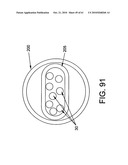 Method and apparatus for restricting flow through an opening in the side wall of a body lumen, and/or for reinforcing a weakness in the side wall of a body lumen, while still maintaining substantially normal flow through the body lumen diagram and image