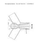 Method and apparatus for restricting flow through an opening in the side wall of a body lumen, and/or for reinforcing a weakness in the side wall of a body lumen, while still maintaining substantially normal flow through the body lumen diagram and image