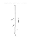 Method and apparatus for restricting flow through an opening in the side wall of a body lumen, and/or for reinforcing a weakness in the side wall of a body lumen, while still maintaining substantially normal flow through the body lumen diagram and image