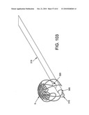 Method and apparatus for restricting flow through an opening in the side wall of a body lumen, and/or for reinforcing a weakness in the side wall of a body lumen, while still maintaining substantially normal flow through the body lumen diagram and image