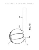 Method and apparatus for restricting flow through an opening in the side wall of a body lumen, and/or for reinforcing a weakness in the side wall of a body lumen, while still maintaining substantially normal flow through the body lumen diagram and image