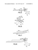 Volar Fixation System And Methods of Using The Same diagram and image