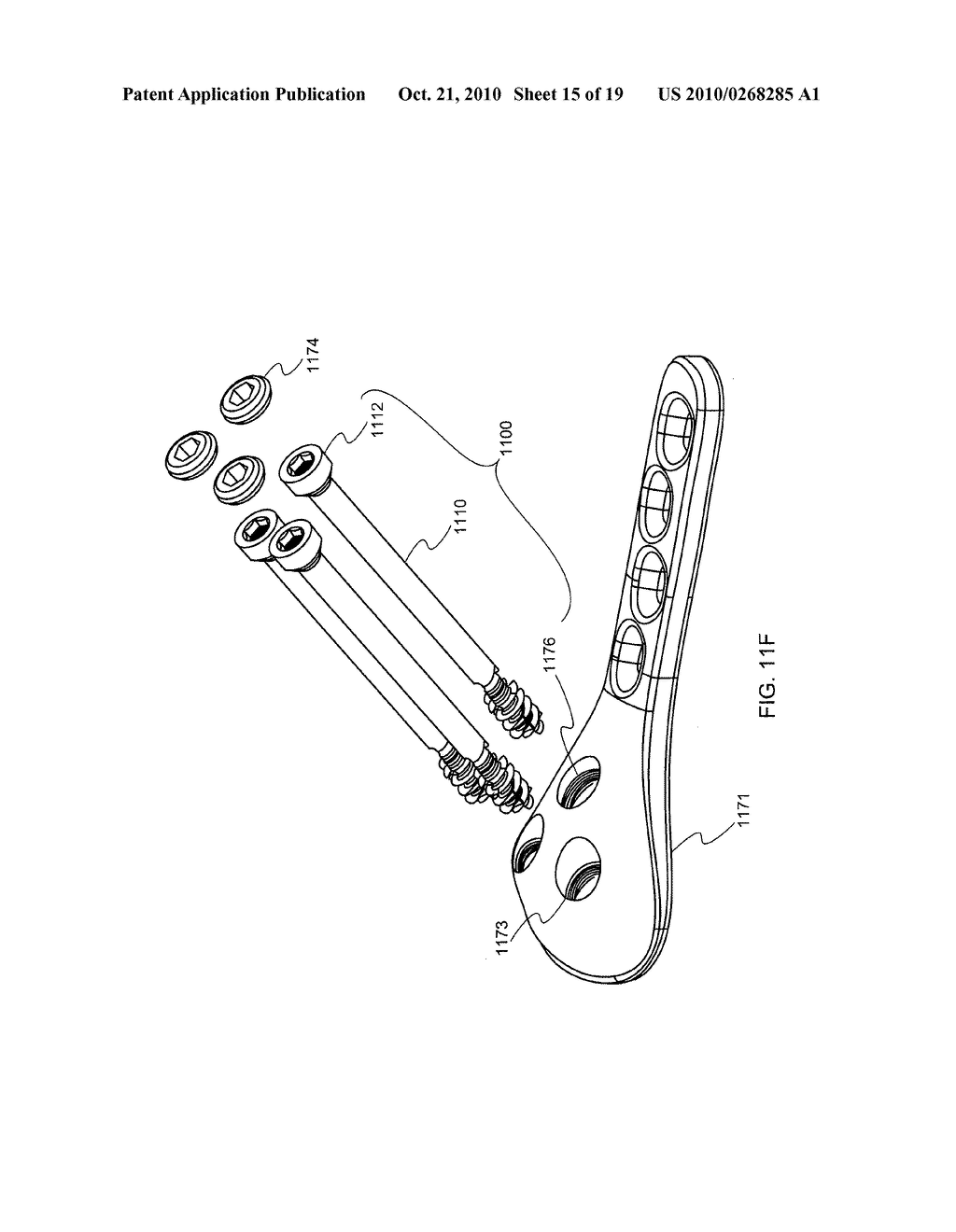 BONE SCREW SYSTEM AND METHOD FOR THE FIXATION OF BONE FRACTURES - diagram, schematic, and image 16