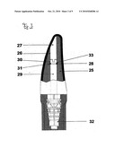 METHOD FOR SECURING A MEDICAL ELEMENT IN AN IMPLANT, AND MEDICAL ELEMENT diagram and image