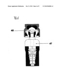 METHOD FOR SECURING A MEDICAL ELEMENT IN AN IMPLANT, AND MEDICAL ELEMENT diagram and image