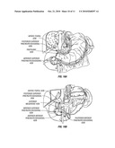 Duodenal Stimulation To Induce Satiety diagram and image