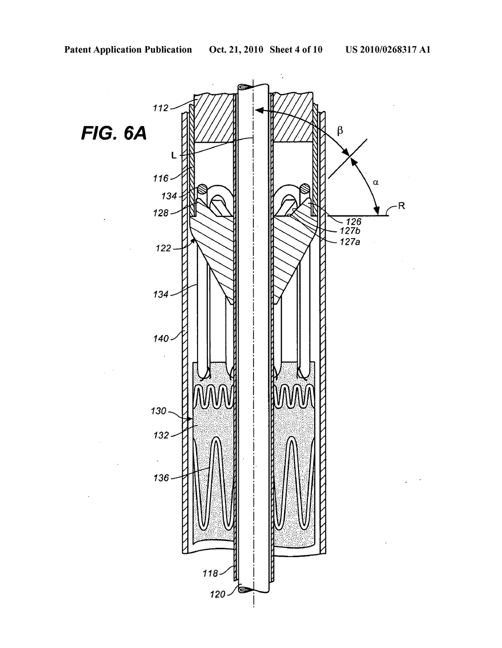 Stent Graft Restraining Mechanism for a Delivery System (Catheter) - diagram, schematic, and image 05