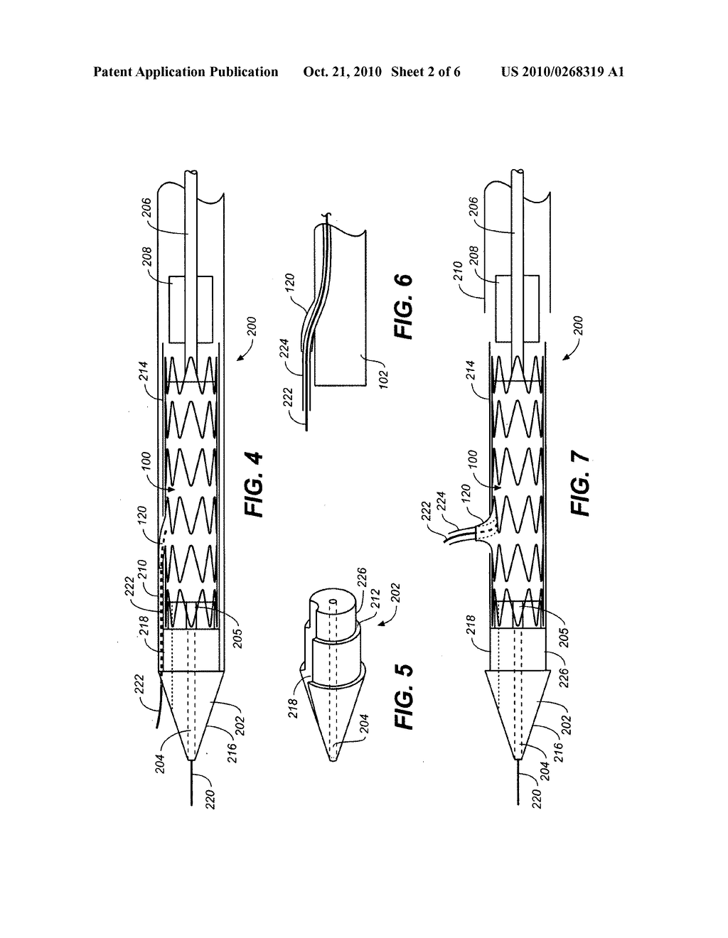 Mobile External Coupling for Branch Vessel Connection - diagram, schematic, and image 03