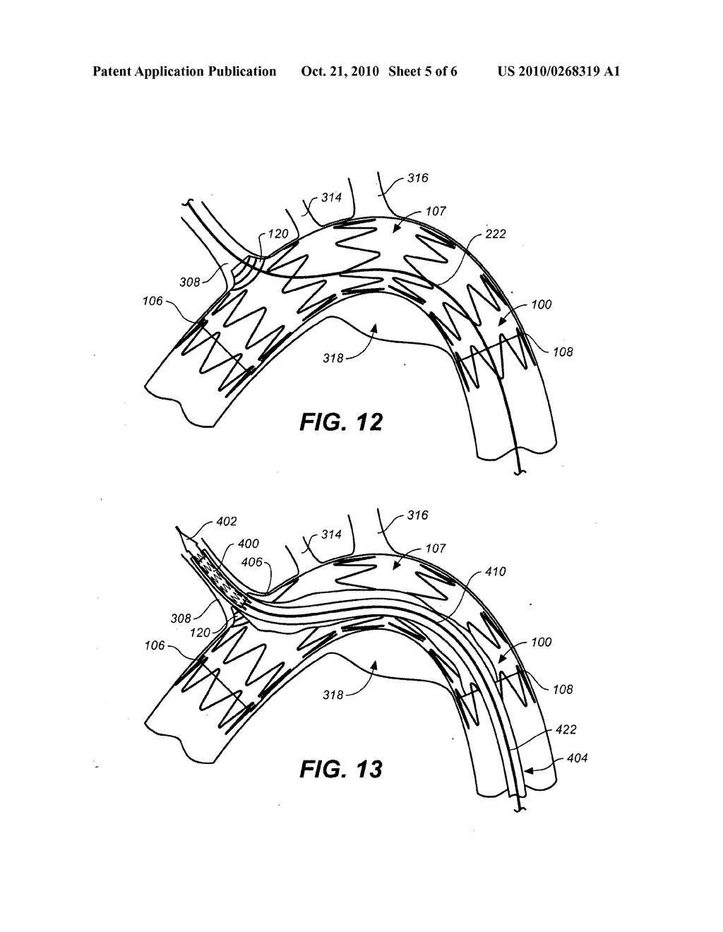 Mobile External Coupling for Branch Vessel Connection - diagram, schematic, and image 06