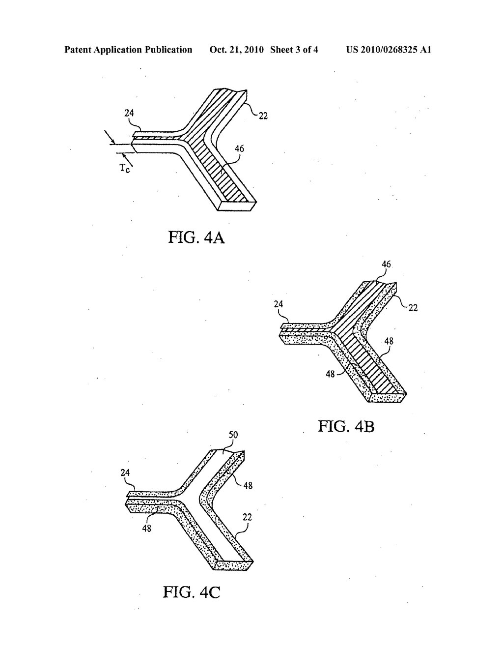 MEDICAL DEVICES AND METHODS OF MAKING THE SAME - diagram, schematic, and image 04