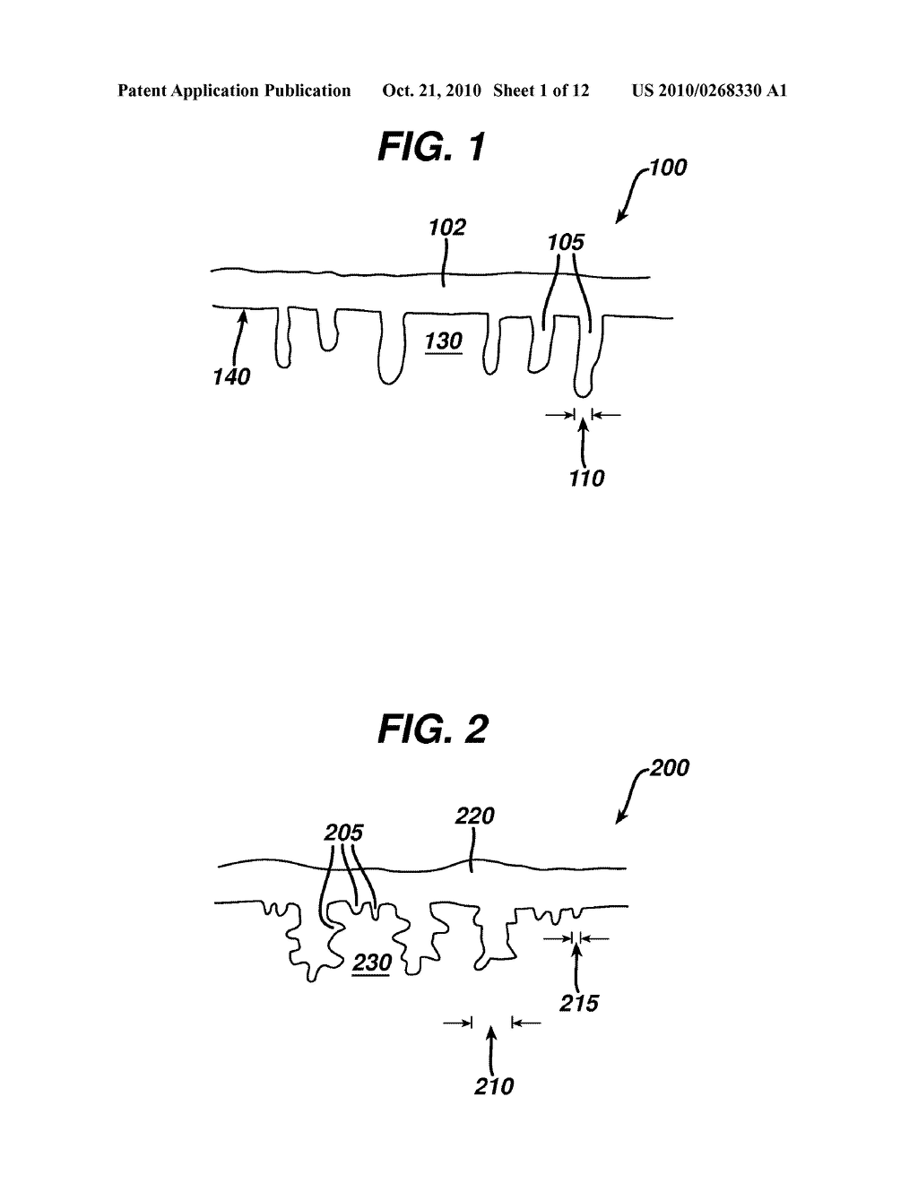 Methods and Devices for Implants with Calcium Phosphate - diagram, schematic, and image 02