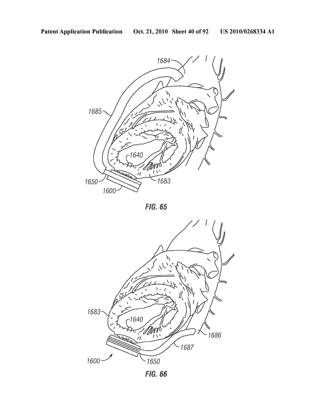 System and Method for Pump Variable Stroke - diagram, schematic, and image 41