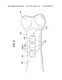 Intervertebral Spinal Implant and Method of Making the Same diagram and image