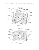 Intervertebral Spinal Implant and Method of Making the Same diagram and image