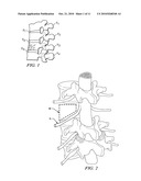 Minimally Invasive Expandable Contained Vertebral Implant and Method diagram and image