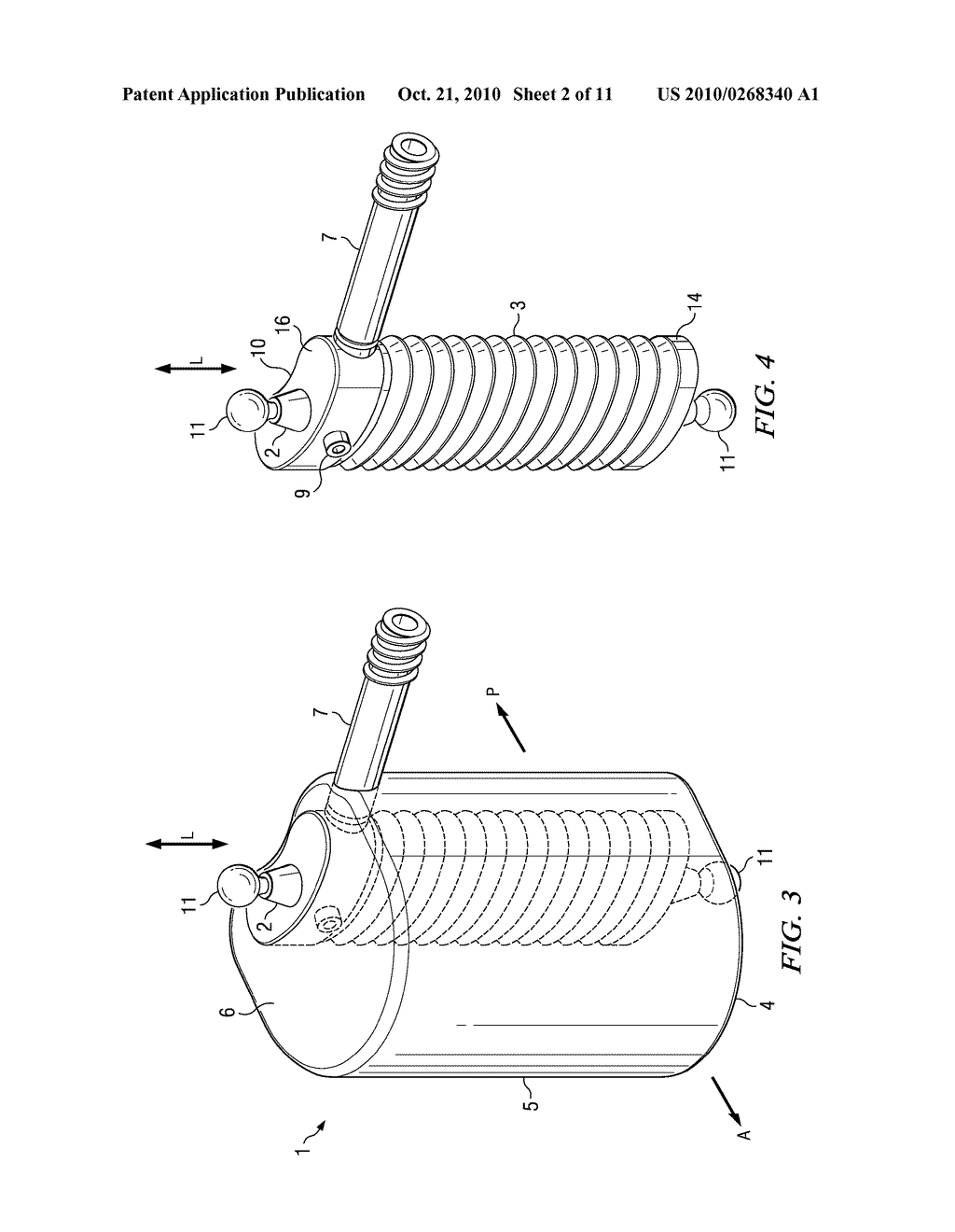 Minimally Invasive Expandable Contained Vertebral Implant and Method - diagram, schematic, and image 03