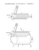 MINIMALLY INVASIVE EXPANDABLE VERTEBRAL IMPLANT AND METHOD diagram and image